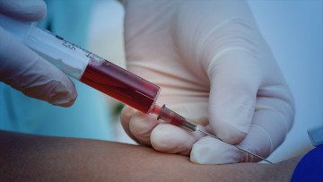 LAB: Extracción de muestra de sangre para análisis clínico. LAB: Extracción de muestra de sangre para análisis clínico.