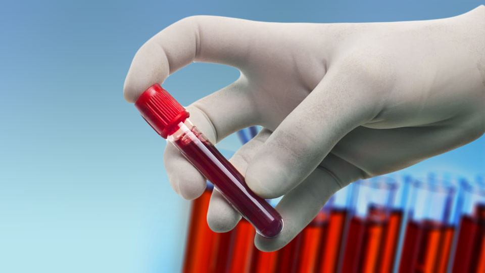LAB · Imagen de una muestra de sangre en tubo sellado.