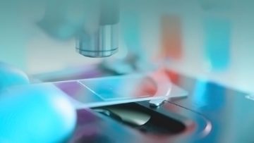 DAP: anatomía patológica al microscopio. DAP: anatomía patológica al microscopio.