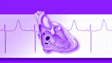 La UIC en el Servicio de Cardiología (CRD) del Grupo San Gerónimo (GSG). La UIC en el Servicio de Cardiología (CRD) del Grupo San Gerónimo (GSG).